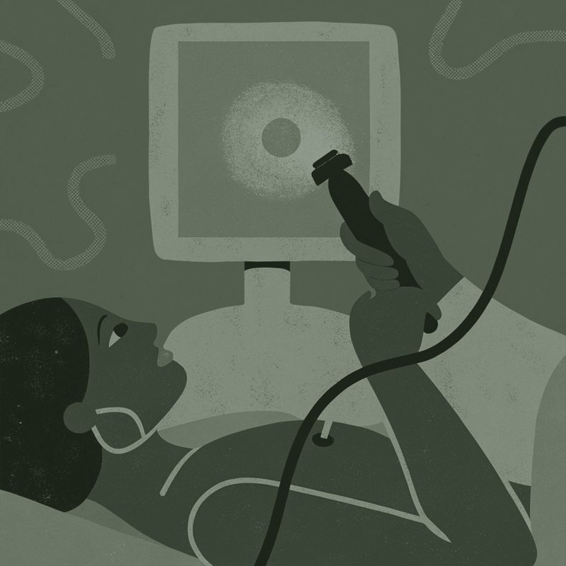 Ilustração de paciente realizando exame de endoscopia
